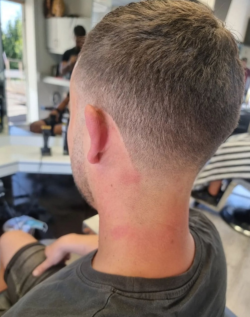 Kort opgeschoren nek en zijkant, van achteren gezien